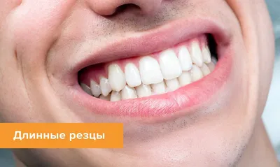 Что зубы говорят о нашем характере? | Журнал Startsmile о стоматологии |  Дзен