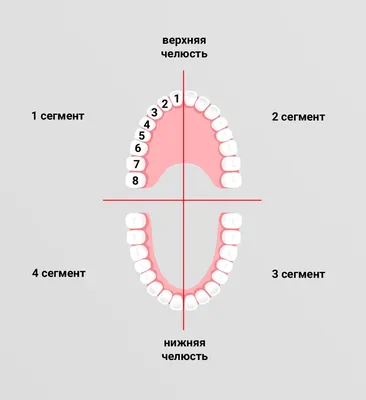 Транспозиция зубов. Почему зубы поменялись местами и как это лечить?