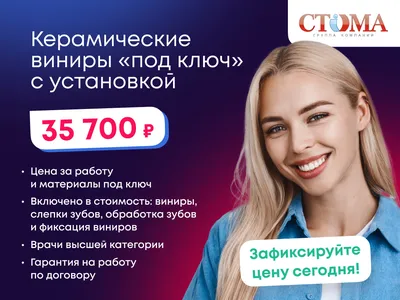 Виниры на зубы – цена в СПб, стоимость установки зубных виниров