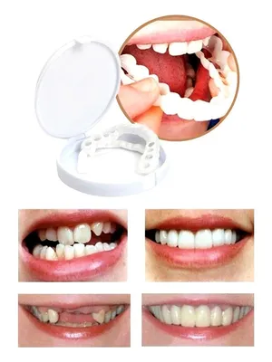 Накладные виниры для зубов GoodStore24 33560285 купить за 158 ₽ в  интернет-магазине Wildberries