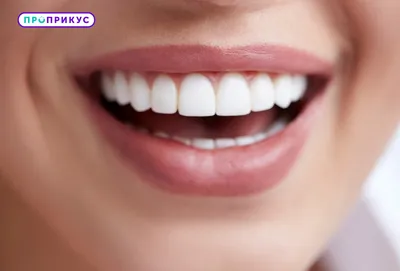 Виниры: что это такое, как ставят на передние зубы, преимущества и  недостатки накладок, цены на установку в стоматологии
