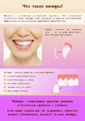 Что такое виниры?» — плакат для стоматологической клиники — Магазин  стоматологических плакатов Stomanet.ru