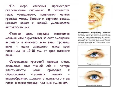 Наблюдения за периорбитальным старением и старением средней зоны лица |  МедЭстет - учебный центр косметологии в Виннице