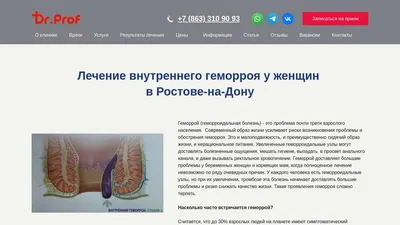 Лечение внутреннего геморроя у женщин в Ростове по выгодной цене -  Doctor-Prof