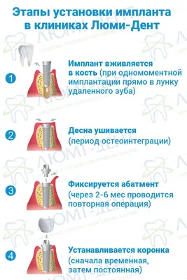 Имплант [1 Зуба] 9 Последствий Установки- ЛюмиДент