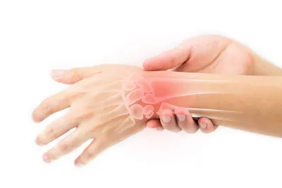 Лечение воспаления связок и сухожилий кисти руки. Тендинит. Ортопедия