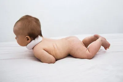 К какому врачу обращаться с кривошией младенца, причины появления у новорожденного и какие методы лечения кривошеи у ребенка