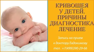 Кривошия у младенцев: симптомы, лечение, профилактика кривошии у новорожденных