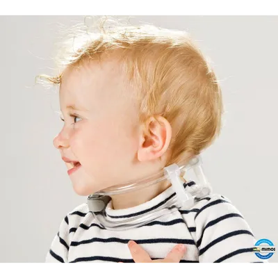 Лечение кривошеи у детей: ортопедический воротник TOT collar