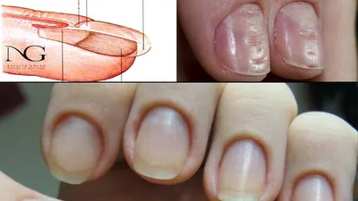 Строение ногтя и проблемы после маникюра. Ответы на вопросы. Periscope /  The structure of the nail - YouTube