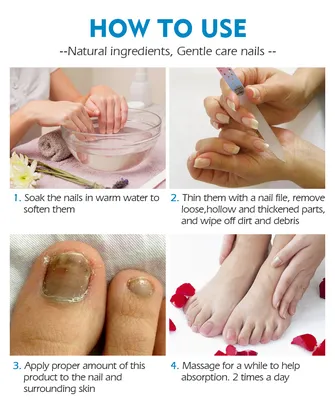 Строение ногтя и ногтевой пластины | Статьи Nail Clinic