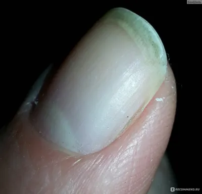 Как ухаживать за ногтями в холода – \"нет\" металлическим пилкам, а гель-лак  не навредит. Новости :section-UKR.NET.
