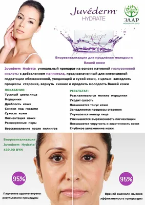 Мезотерапия лица и кожи головы. Биоревитализация в Минске | Медицинский  центр ЭЛАР в Минске