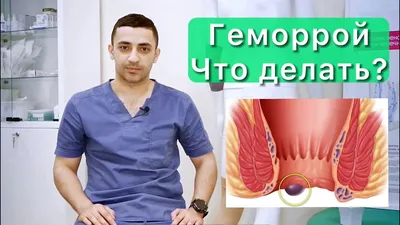 On Clinic - Ani - Что такое геморрой? Геморрой представляет собой  заболевание, при котором происходит варикозное расширение вен прямой кишки  и образование геморроидальных узлов. Симптомы геморроя: 1.дискомфорт в  анальной области 2.кровотечение при