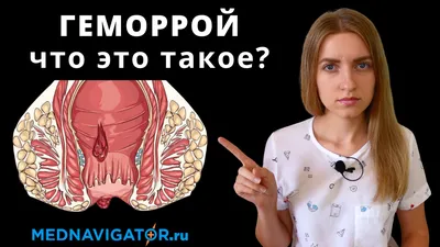 Геморрой как он есть и как его лечить, чтобы не было мучительно больно