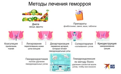 Как повлиять на качество жизни после хирургического лечения геморроя?  Полезный журнал о наболевшем «Найз Здоровье» :- Medznat