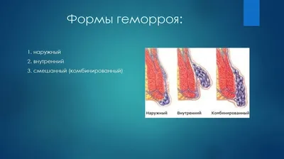 ✓ Проктология: Как лечить... - Медицинский центр \"МедПросвет\" | Facebook