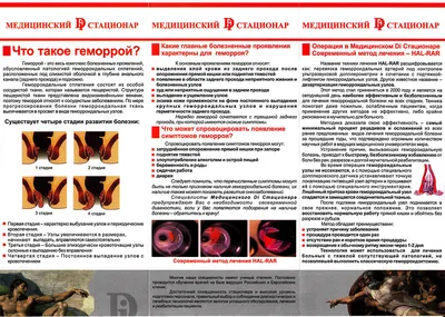 Геморрой у мужчин и женщин - суть проблемы, причины, симптомы, стадии,  лечение | Mednavigator.ru | Дзен