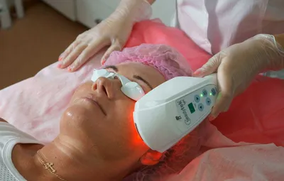 Услуги лазерной биоревитализации кожи в Екатеринбурге — Академическая  клиника