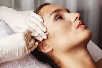 Мезотерапия для лица: цена в Москве, инъекционная процедура для кожи в  клинике косметологии