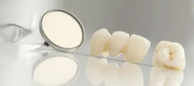 Коронки на передние зубы: виды, материалы, преимущества и недостатки