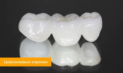 Как ставят коронку на зуб — этапы, фото до и после установки зубных коронок  на Startsmile.ru