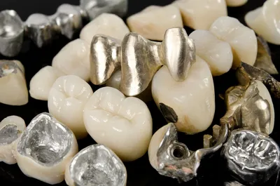 Какие зубные коронки лучше - Полезные статьи на сайте стоматологической  клиники Церекон