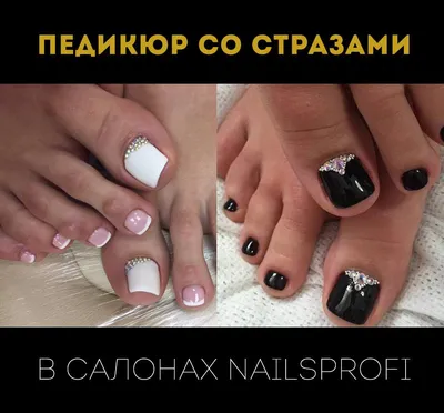 Педикюр со стразами - Студия красоты \"NailsProfi\"