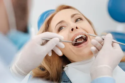 Лечение кариеса зубов в клинике современной стоматологии Ваш выбор в  Благовещенске