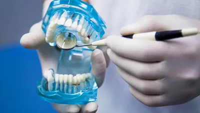 Кариес зубов: виды, симптомы и лечение | Стоматология Smile Office
