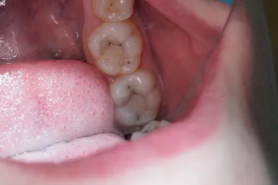 Мой ужасные зубы 2( | Пикабу