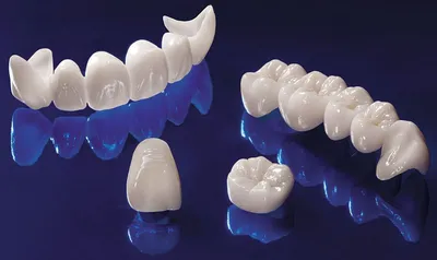 Циркониевые коронки на передние зубы - показания, уход, этапы  протезирования | Недорогая Стоматология в Москве