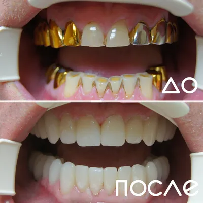 Примеры работ ООО Стоматология
