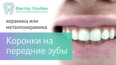 Коронки на передние зубы в Санкт-Петербурге: цены, фото в клинике Фактор  Улыбки