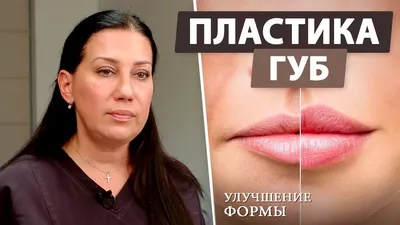 👄 Красивые губы без филлеров: что такое булхорн? - YouTube