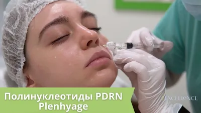 Инъекции Plenhyage || Полинуклеотиды PDRN для лица || - YouTube