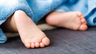 Плоскостопие у ребёнка | медицинские товары и медтехника в магазине  Ортосалон