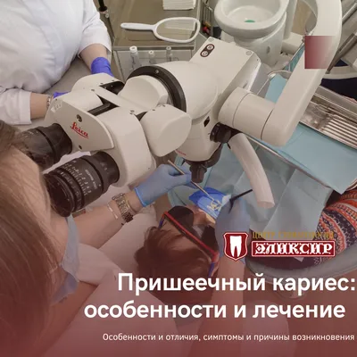 Пришеечный кариес: чем отличается и как его лечить - стоматология в Томске