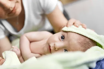 Деформация головы у новорожденного - что нужно знать родителям -  beautyvertebro.com