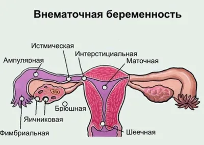 ВНЕМАТОЧНАЯ БЕРЕМЕННОСТЬ: СИМПТОМЫ И ПРОГНОЗЫ | Беременность - лучшее время  🌺 | Дзен