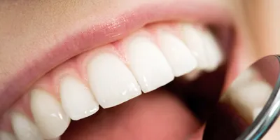 Aesculap - Глубокий кариес 🦷 ⠀ Кариес - это серьезное заболевание, которое  может возникнуть от, казалось бы, безобидного потемнения на зубе. Без  лечения кариес прогрессирует и развивается в опасные воспалительные  процессы, грозящие