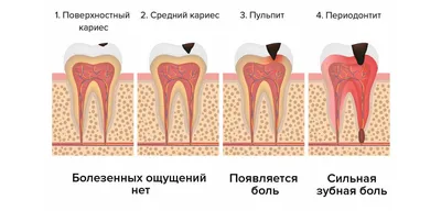 Средний чек лечения кариеса зубов - Стоматологическая клиника доктора Дахно