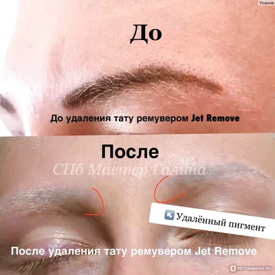 Препарат для удаления перманентного макияжа и тату Jet Remove - «JetRemove  лучший ремувер » | отзывы