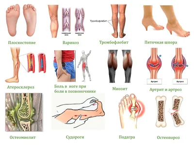 Болят ноги от колена до ступни причины боли в голени и методы лечения