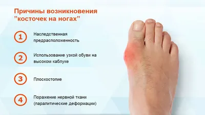 Болит косточка на ноге сбоку – что делать? | Med-magazin.ua - cеть  магазинов медтехники