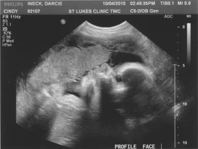 32 недели беременности: вес ребенка, норма для плода, фото с УЗИ