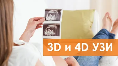 УЗИ 3D и 4D - клиника Семейный доктор