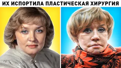 Сделанные» лица: 5 российских актрис, которые потеряли «изюминку» после  пластики