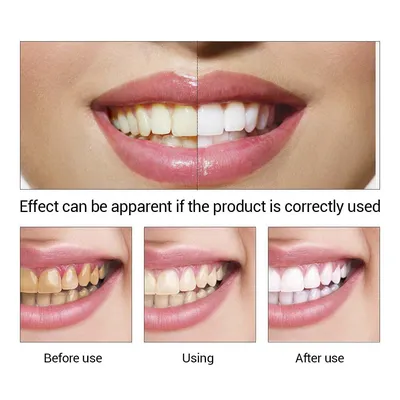 Очищающая Сыворотка для зубов Идеальный Гель для отбеливания зубов удаление зубного  камня ослепительный белый отбеливатель зубов белый зуб воды | Красота и  здоровье | АлиЭкспресс