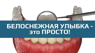 Зубной камень: способы и методы борьбы, профилактика. Как избавиться от зубного  камня?